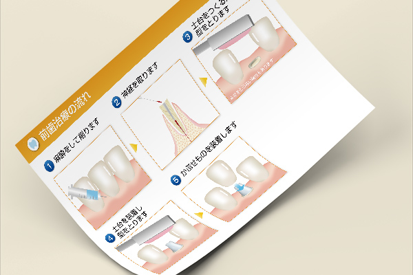 歯の治療はどうして時間がかかるの?
