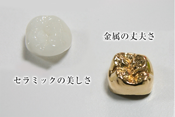 違いその1：美しさ