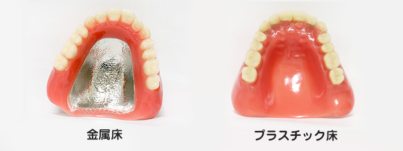 入れ歯による治療
