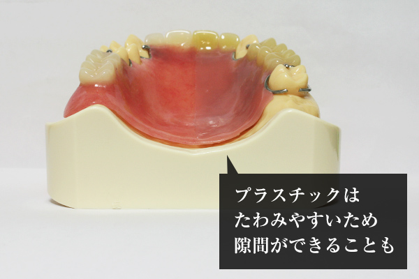 違いその1：違和感（薄さ）