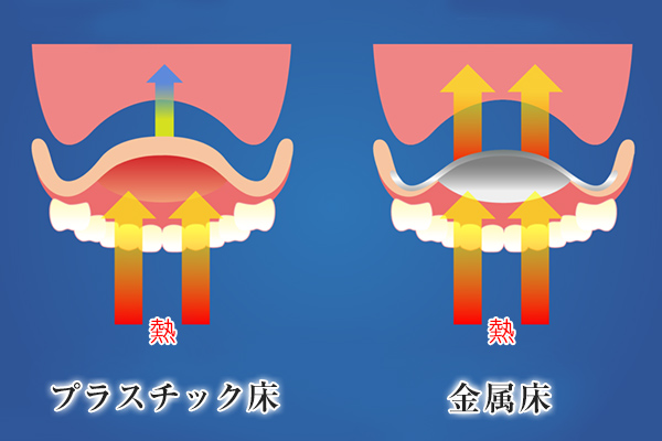 違いその2：安定性（よく噛める）