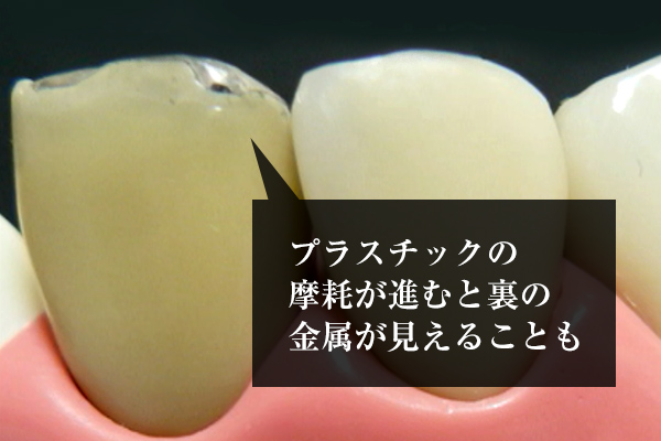 違いその1：美しさ