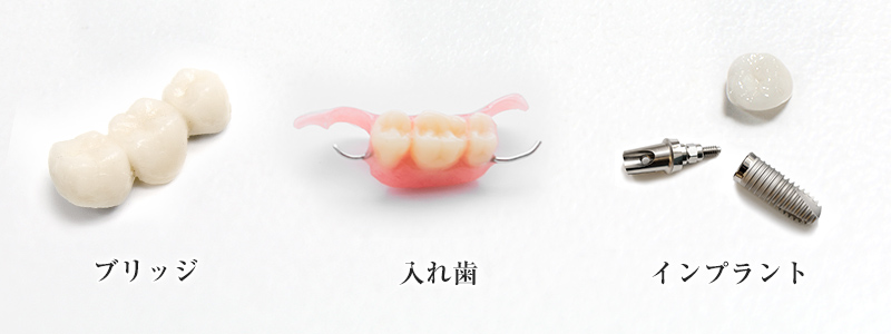 失った歯を補う治療