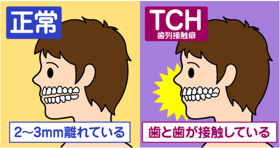 長時間のスマホで顎関節症に!? お口のトラブルを招く「TCH(歯列接触癖)」とは