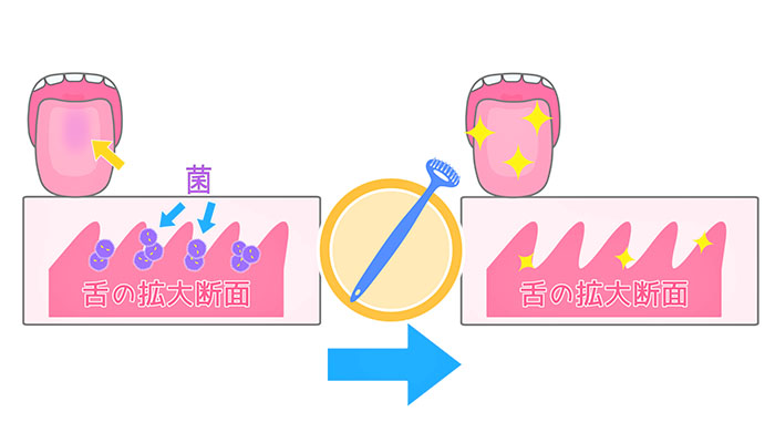マスクの中のニオイの原因