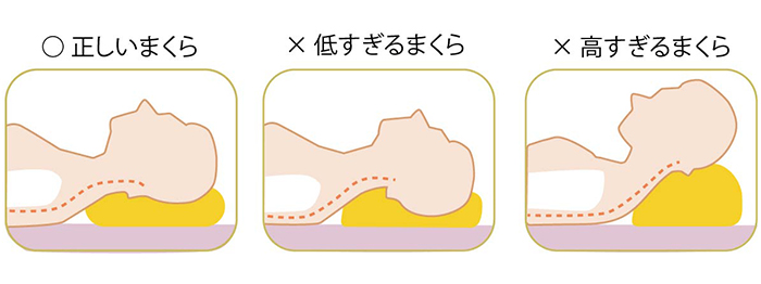 顎(がく)関節症を防ぎましょう