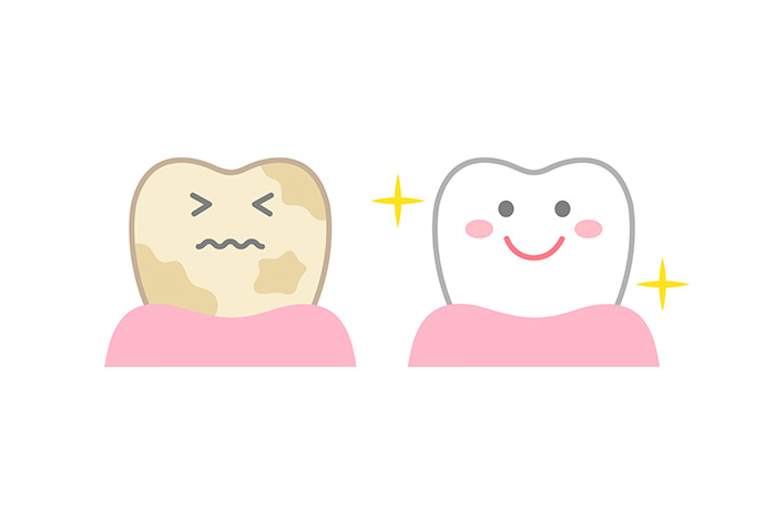 やっぱり気になる「歯の着色」