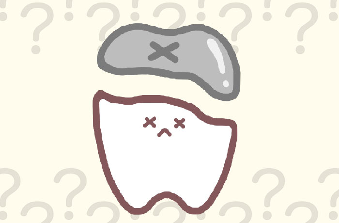詰め物が外れてしまう理由と注意点