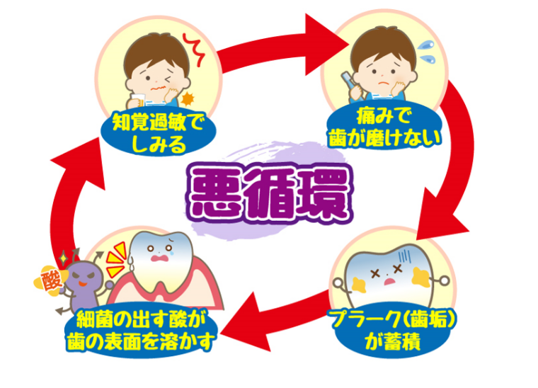 ◆知覚過敏が 「悪循環」を生む!