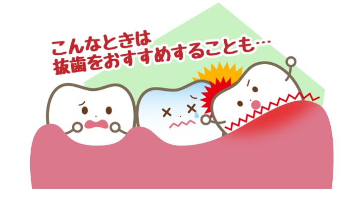 スクリーンショット 2022-09-04 122016
