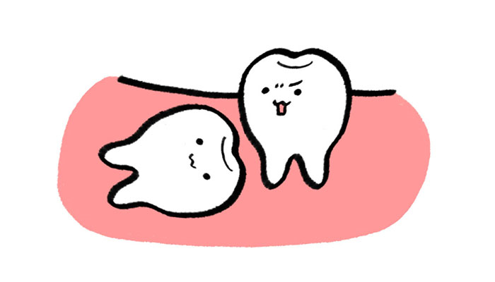 レントゲン撮影ってどうして必要なの?