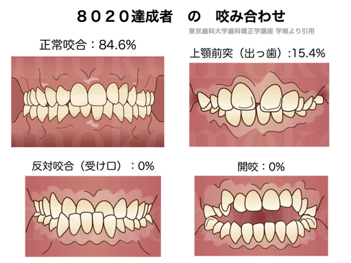 8020達成者の咬み合わせ20240422仲町歯科