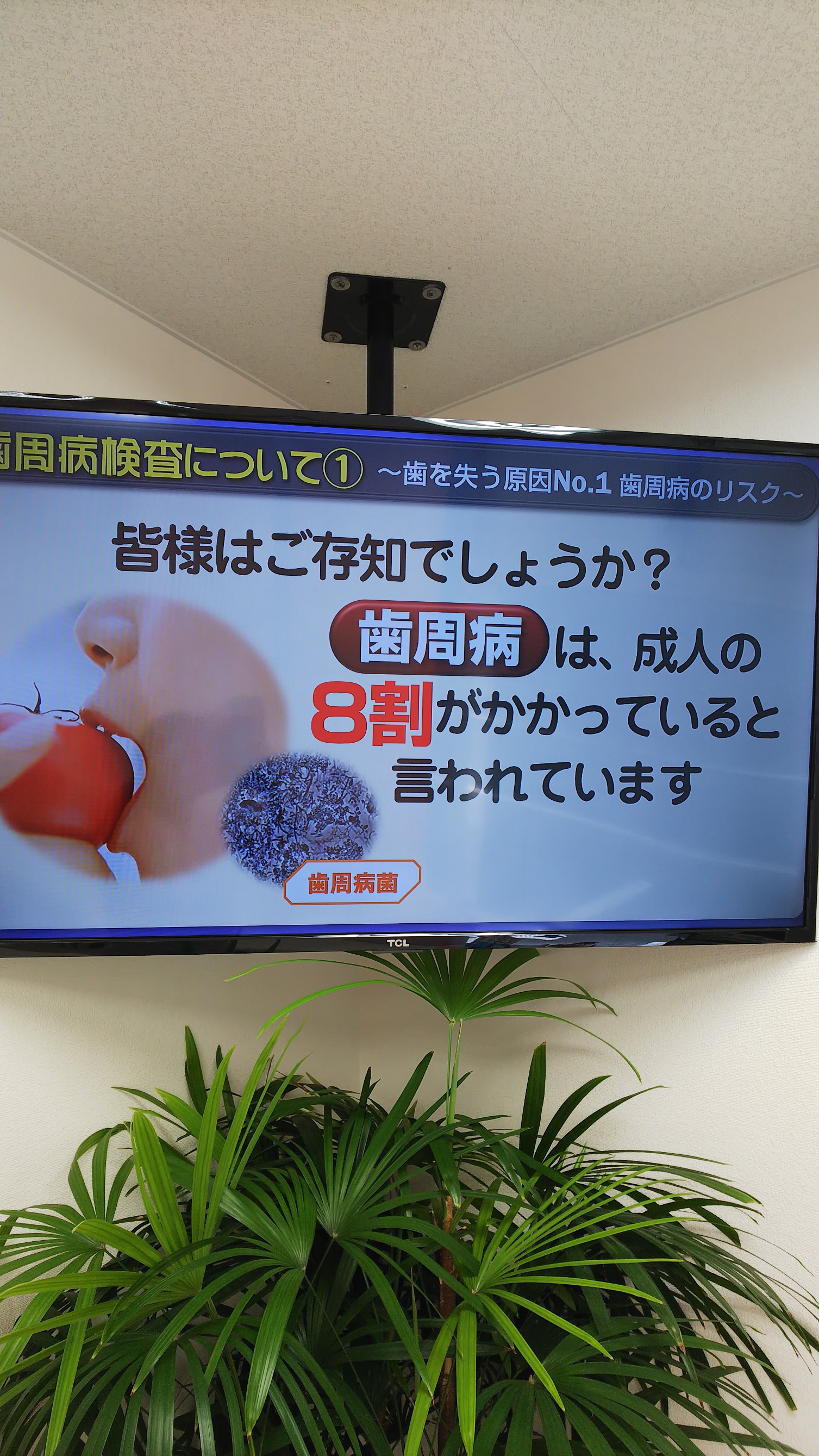 予防の大切さについて
