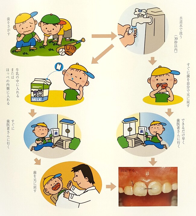 ②根から抜けた場合