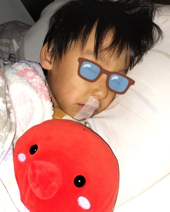 5歳児プレオルソ矯正スタート！