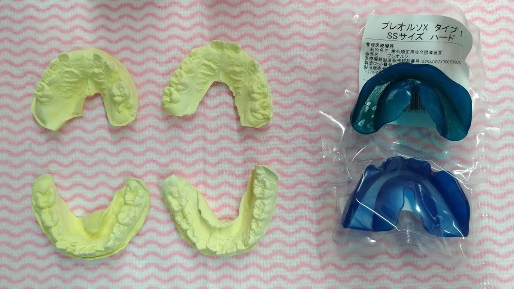 前歯が内側に生えてきた 周智郡森町