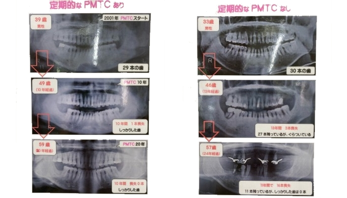 すごいぞPMTC！　周智郡森町