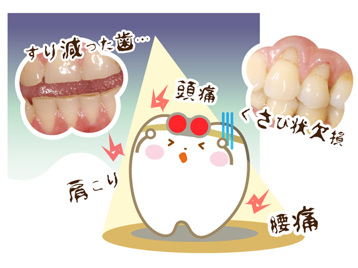 歯ぎしり01
