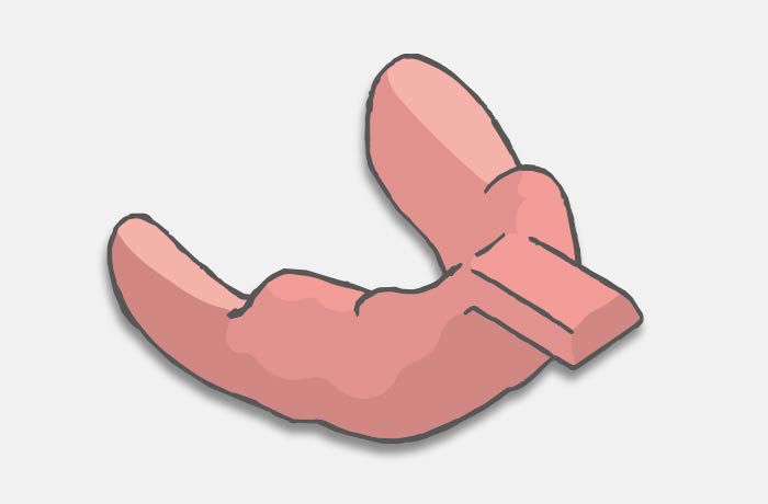 2.個人トレーを使用して精密な印象を採る