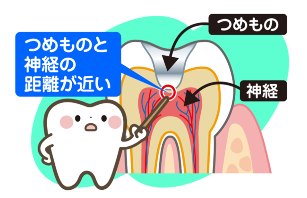 🦷「つめもの」をしたのに歯がしみる!?