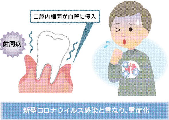 なぜ3ヵ月毎のPMTCがおすすめなのか? 周智郡森町