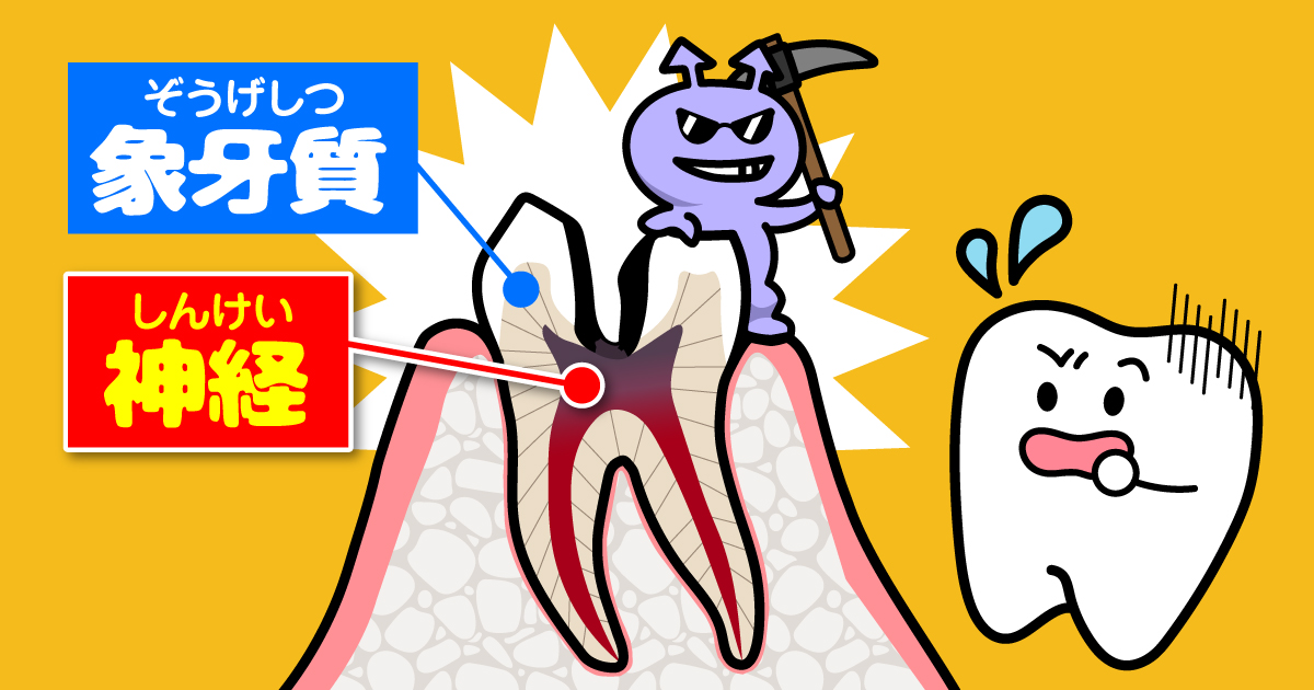 ◆痛みを感じたら、ただちに歯科へ!