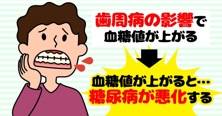 歯周病で「血糖値が上がる」って本当?
