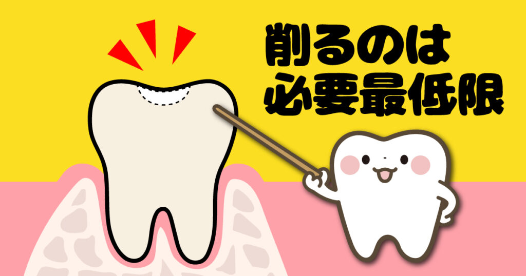 ◆見た目だけじゃない! 歯の健康を守るCRの魅力