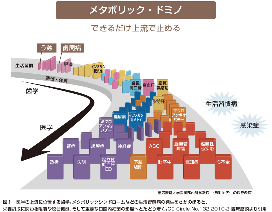 なぜ3ヵ月毎のPMTCがおすすめなのか? 周智郡森町