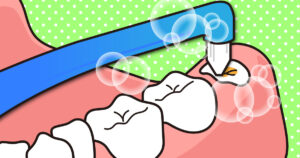 ◆無理に抜く必要はありません