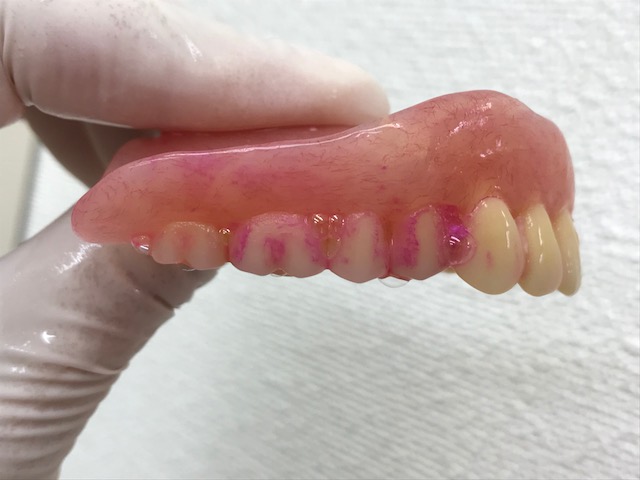 入れ歯もしっかり磨いてね！