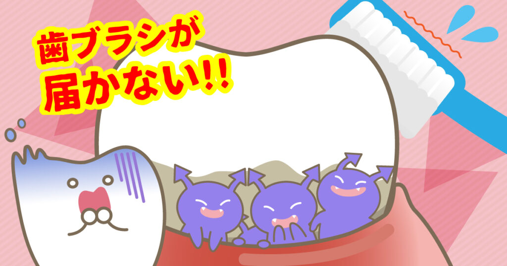 ◆ポケットが深くなるだけじゃない！