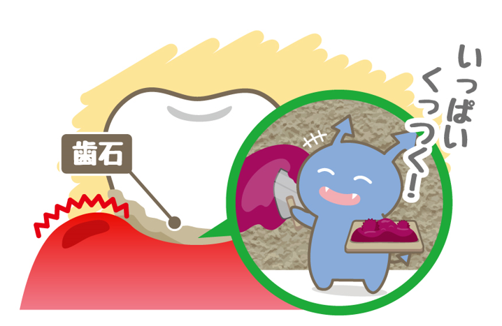 ♡放置すると歯が抜ける･･･!?