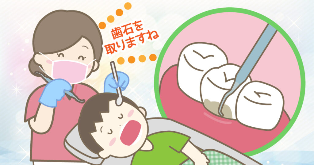 ◆歯周ポケットを深くしないために