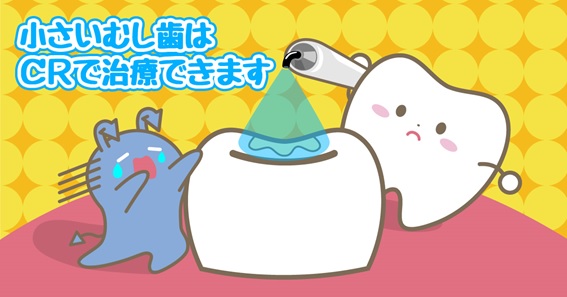 ◆むし歯は小さいうちに治そう