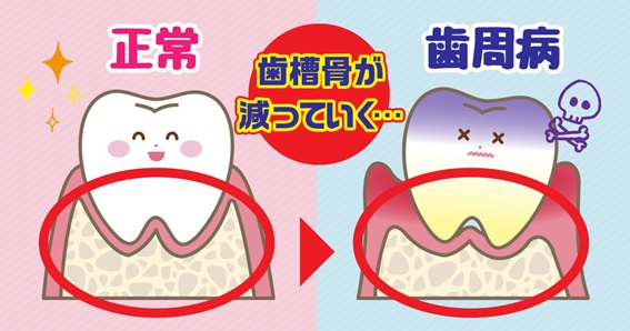 ここまで見える!歯のレントゲン撮影