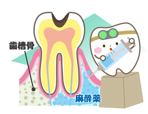 「痛みの少ない歯科治療」には欠かせません